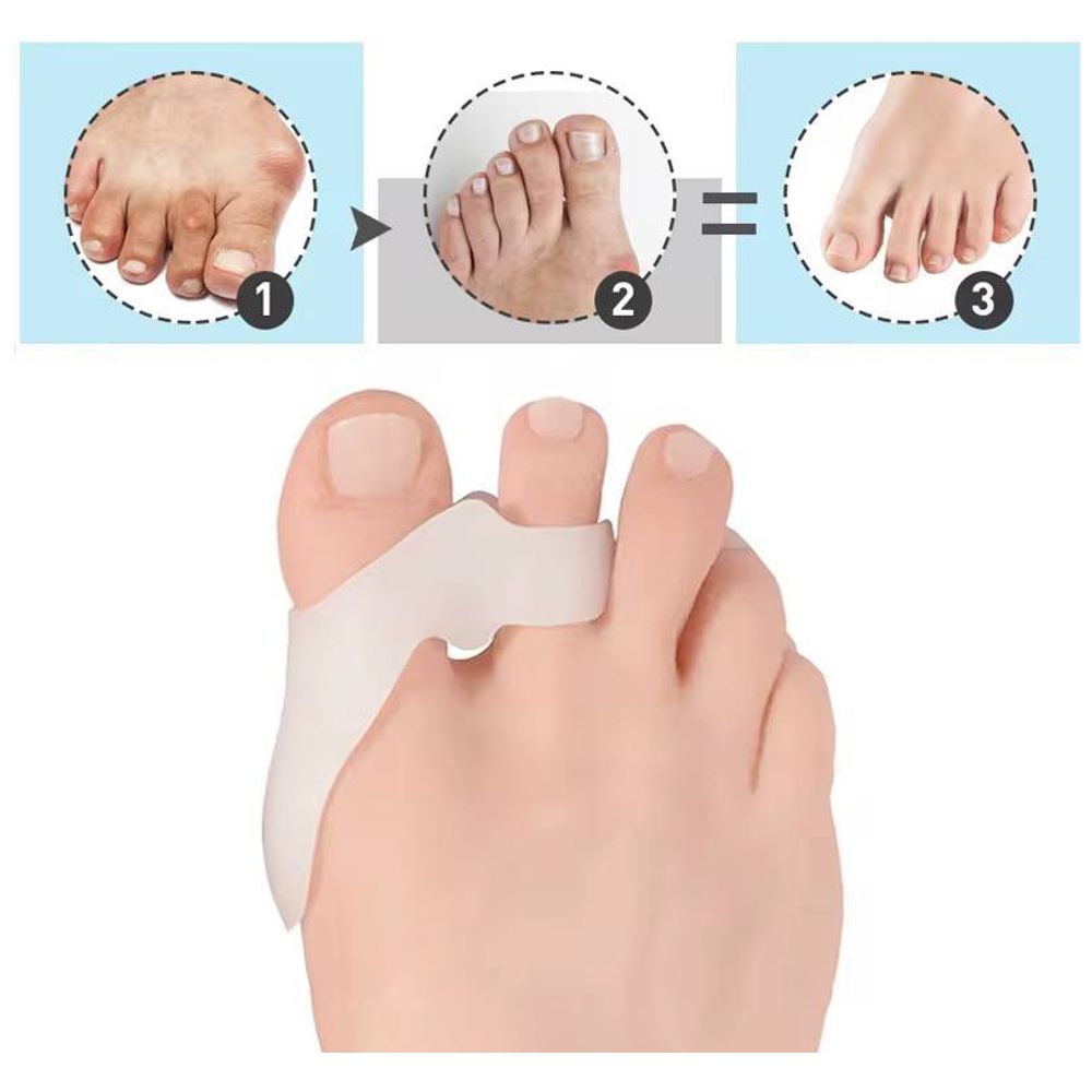 Silicone Medical Toe Protector - 6986bRN