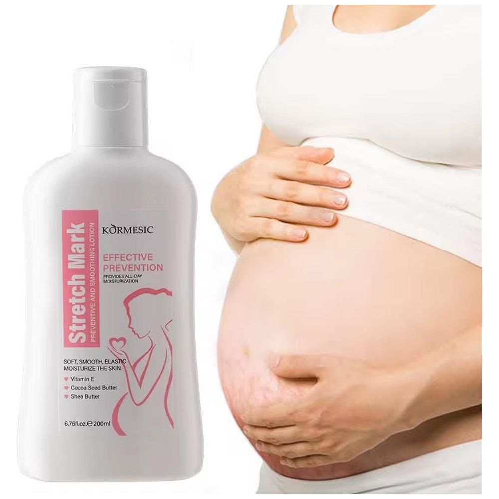 Dr Rashel Stretch Mark Cream - 200ml