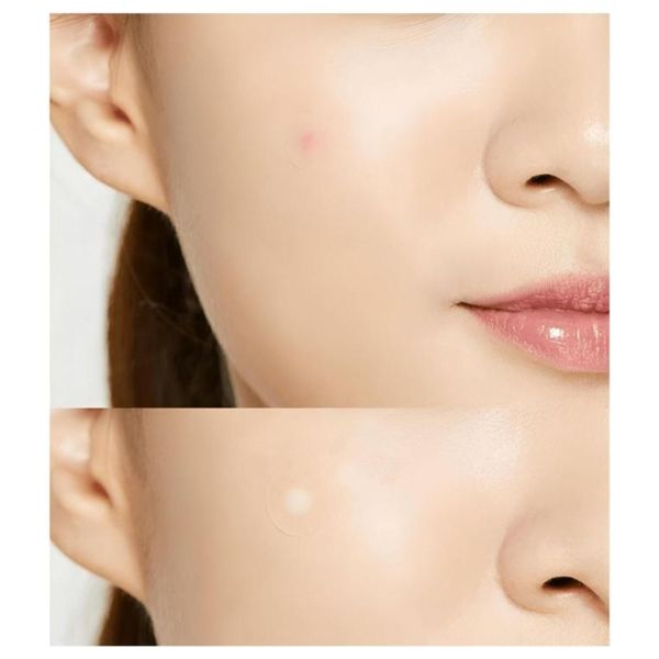  Cosrx Acne Pimple Master Patch - 24 pieces 