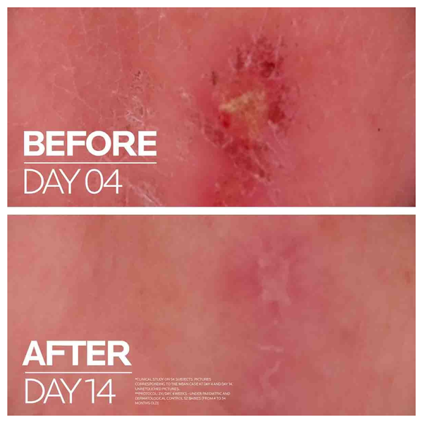 لاروش بوسيه سيكابلاست بلسم B5+ المرمم والملطف - 70 مل