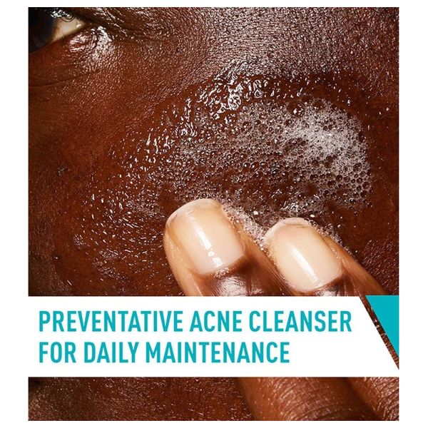 CeraVe Acne Control Cleanser - 237 ml