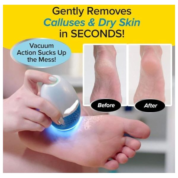  Foot Care Device - K-021 - White 