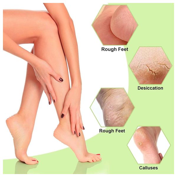  Medical Silicone Foot Care Socks - White 