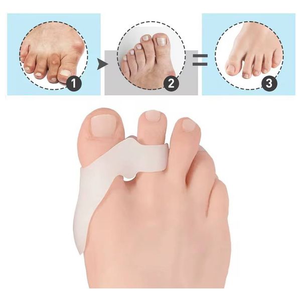  Silicone Medical Toe Protector - 6986bRN 