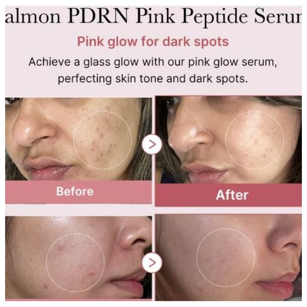  Medicube PDRN Pink Peptide Serum - Skin Regeneration & Radiance, 30 ml 